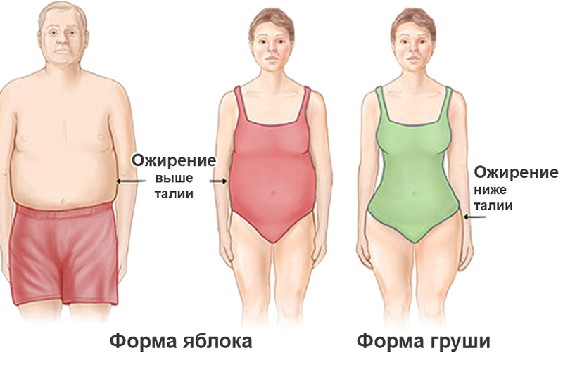 Распределение жировой ткани по телу в виде яблока и груши картинка